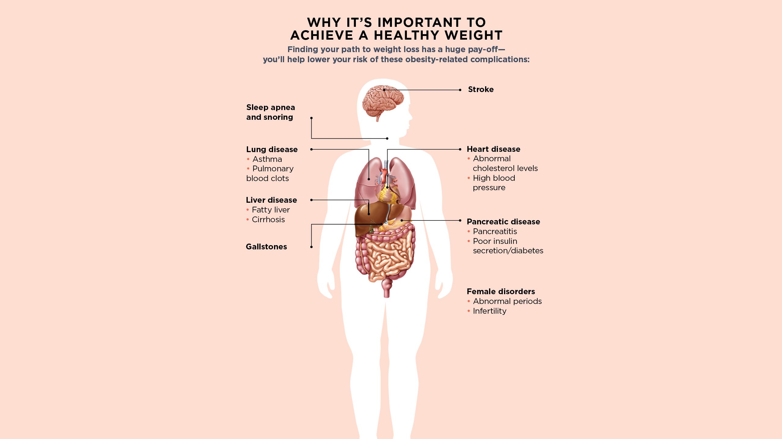 An illustration of human organs and disease descriptions. (Sleep apnea, lung disease, liver disease, gallstones, stroke, heart disease pancreatic disease.) 